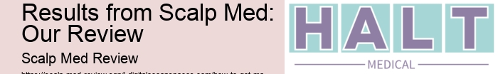 How to Get Maximum Results from Scalp Med: Our Review 